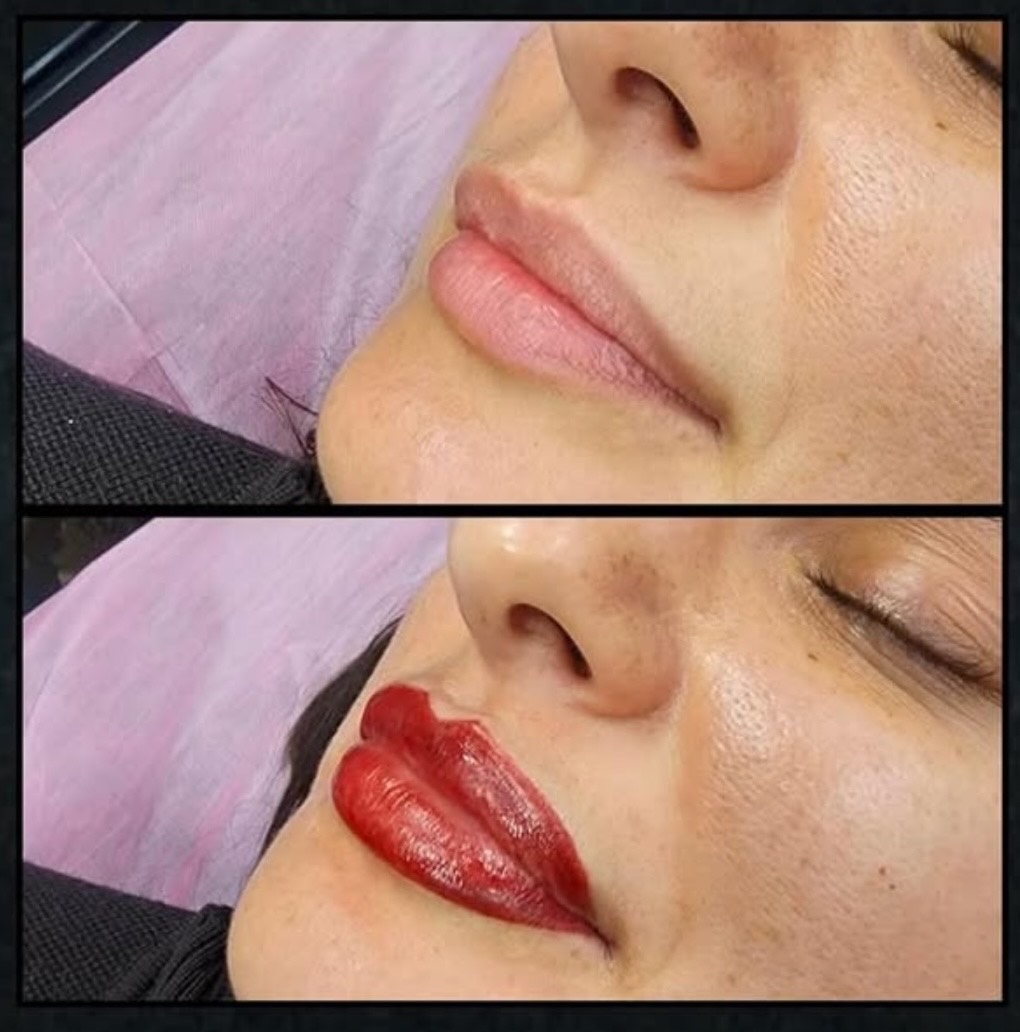Colour tattoo removal by Kat